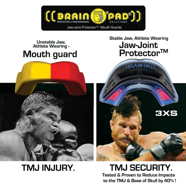 Brain Pad 3Xs Mouth Guard